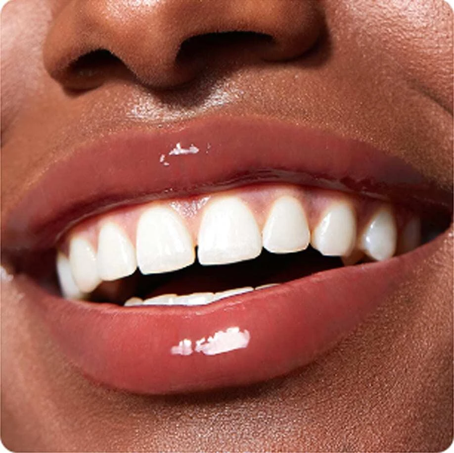 Lips